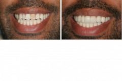 2022-jr-2x4-opt