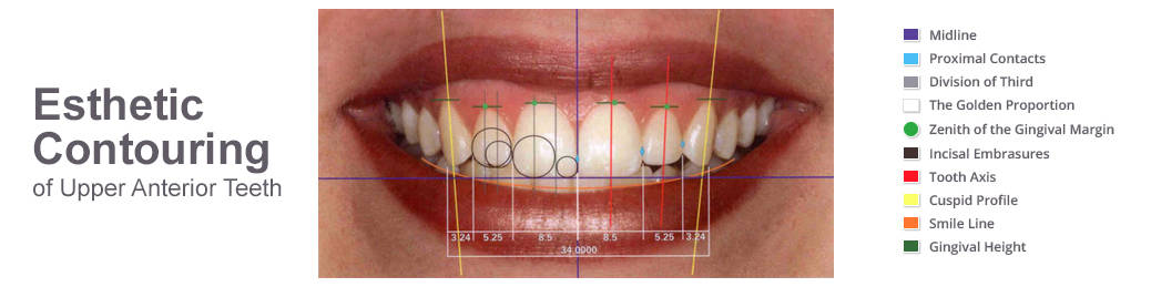 cosmetic dentistry Services