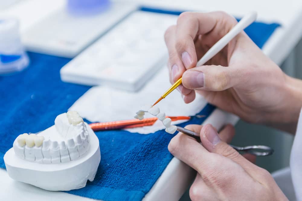 What are Dental Crowns Fort Lauderdale?
