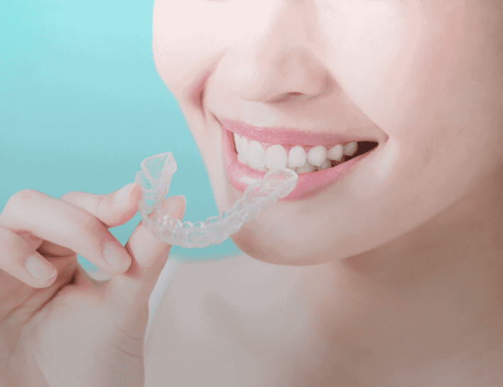 Dental invisalign caps